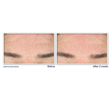 ROC Retinol Correxion Deep Wrinkle Serum Cleanser