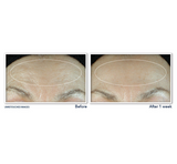 ROC RETINOL CORREXION LINE SMOOTHING DAILY SERUM