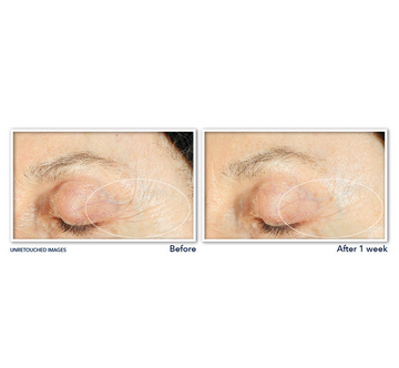 ROC RETINOL CORREXION LINE SMOOTHING DAILY SERUM