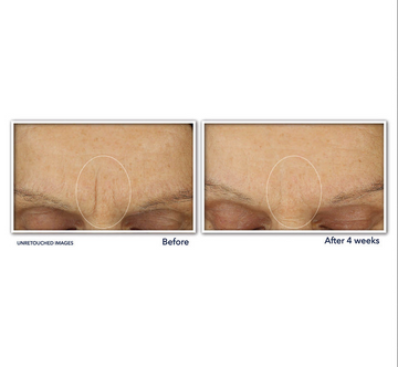 RoC Retinol Correxion Line Smoothing Max Hydration Cream